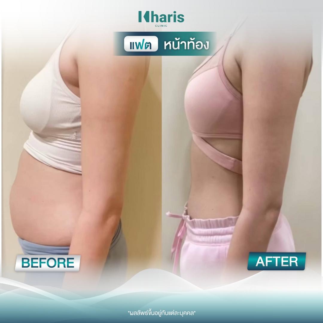 Fat Reduction review 11