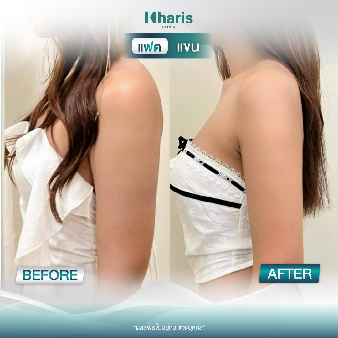 Fat Reduction review 12