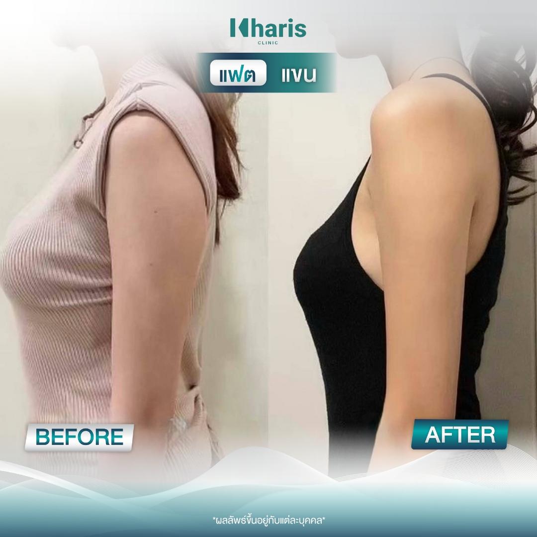 Fat Reduction review 13