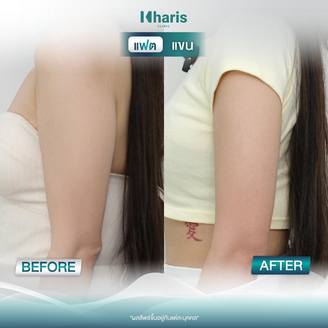 Fat Reduction review 18