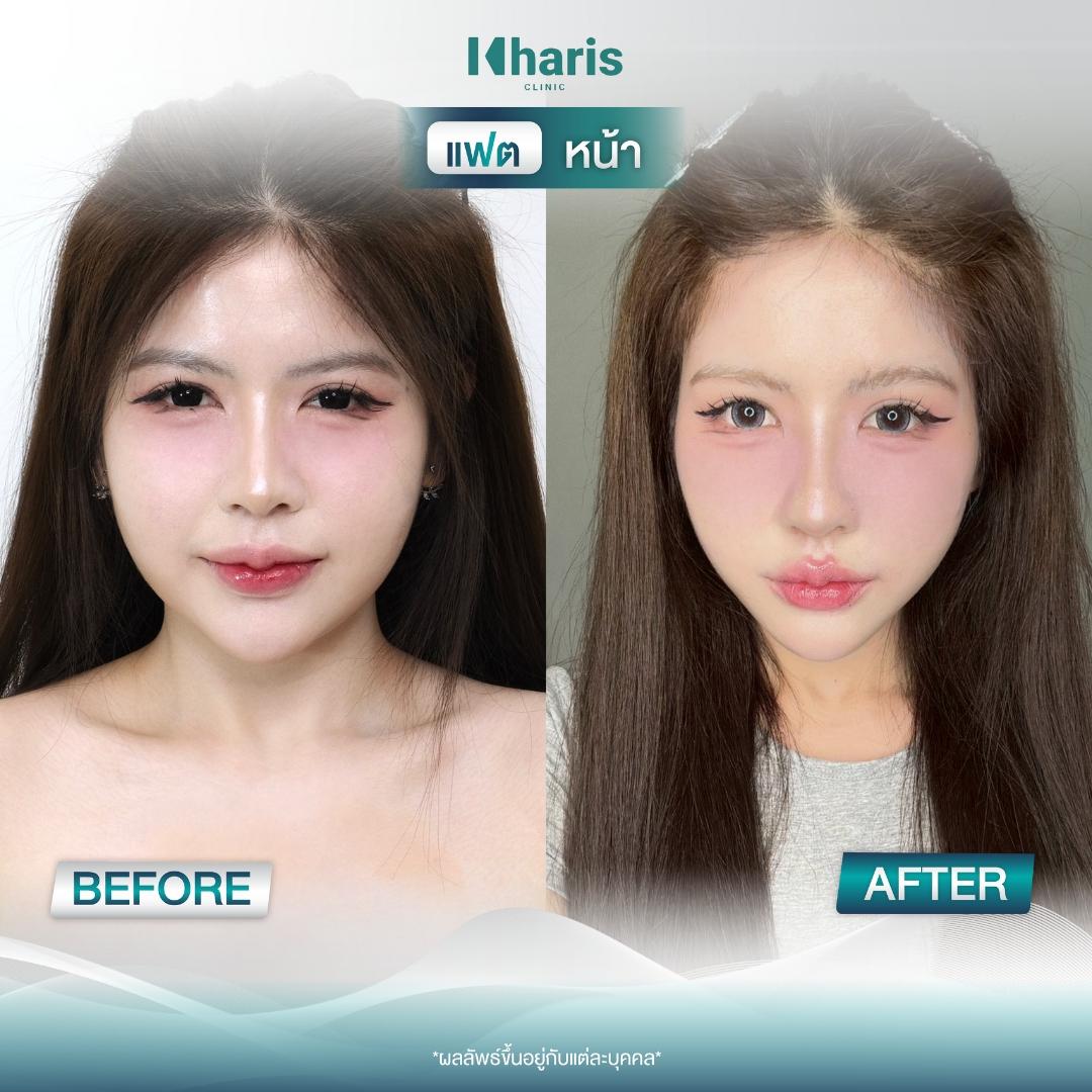 Fat Reduction review 19