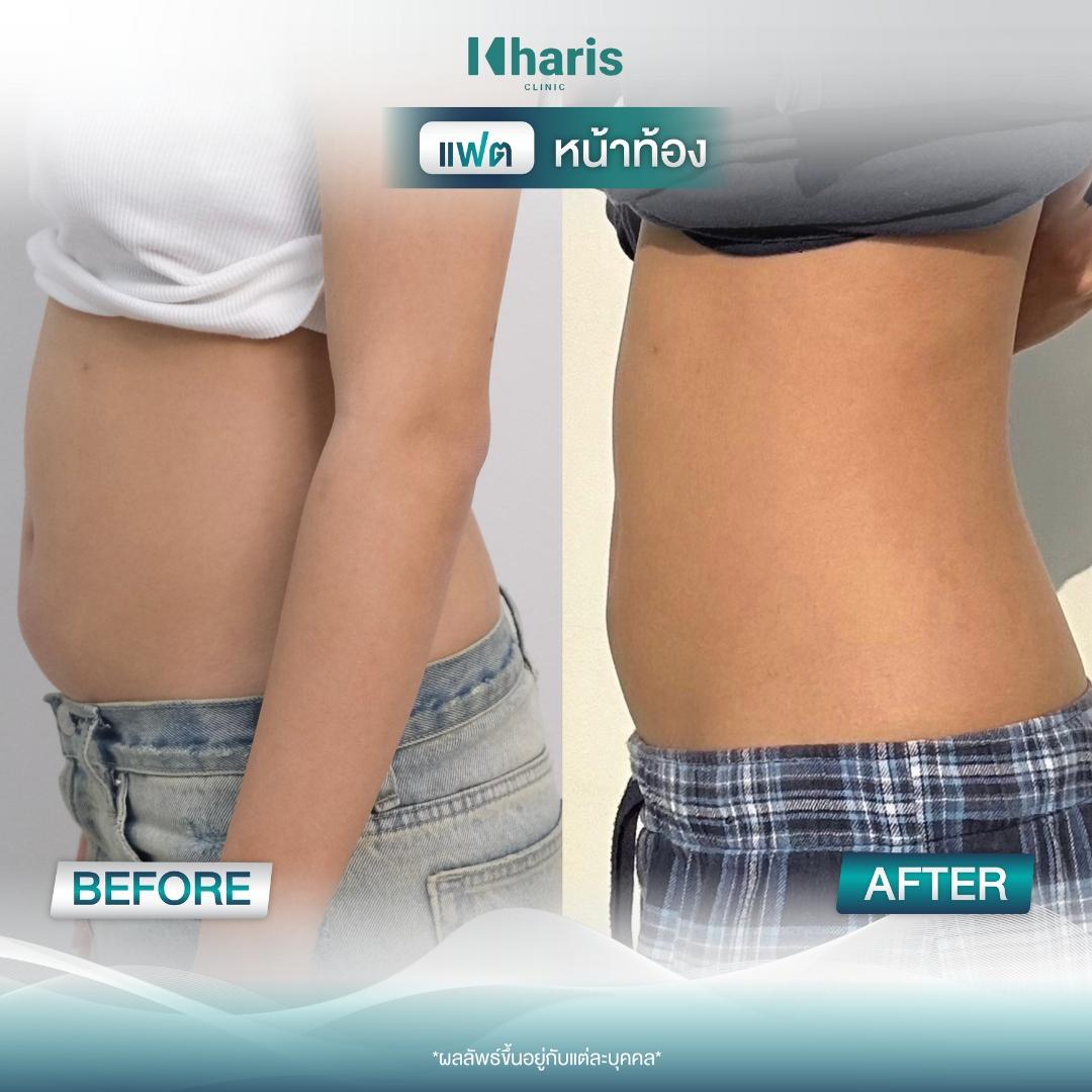 Fat Reduction review 22