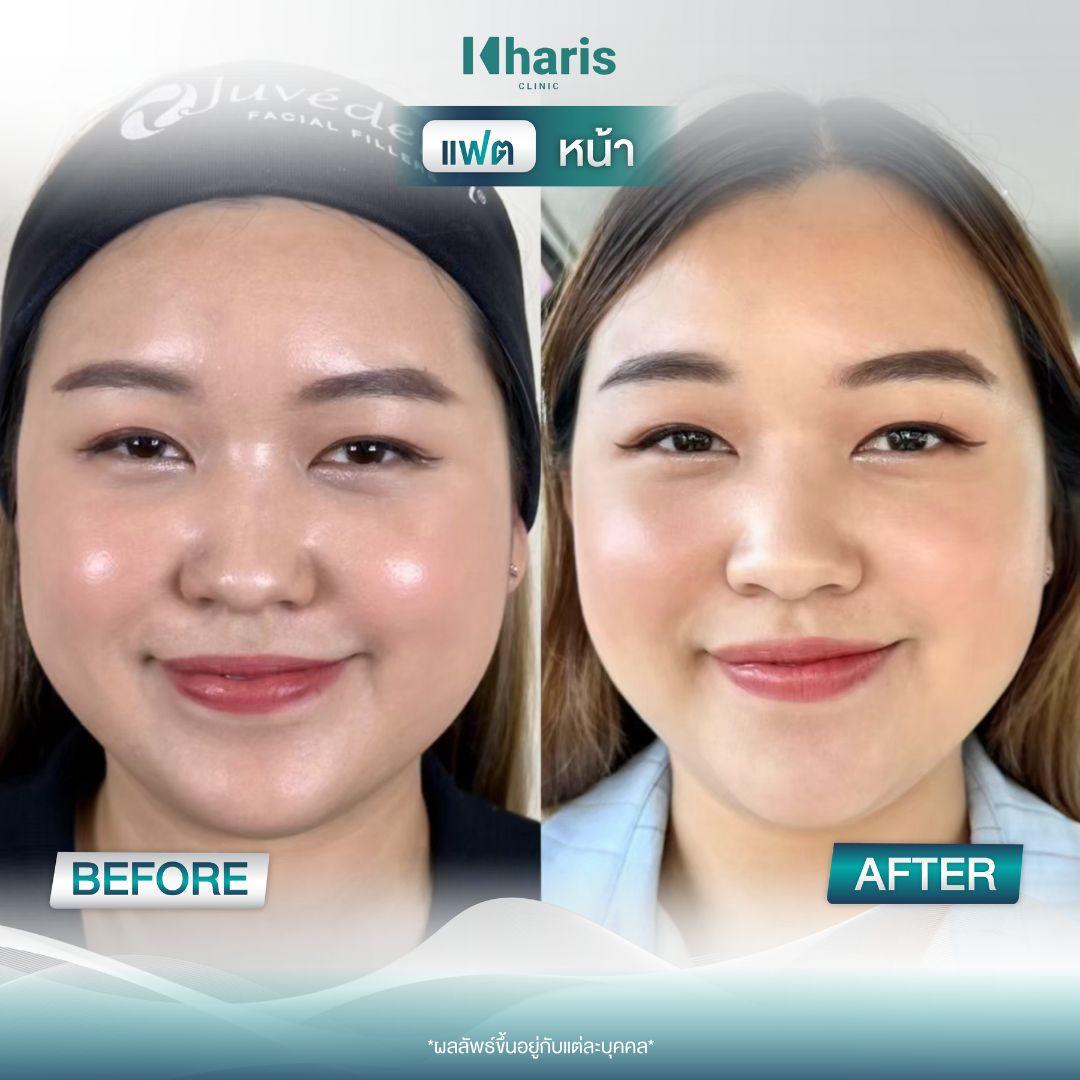 Fat Reduction review 6