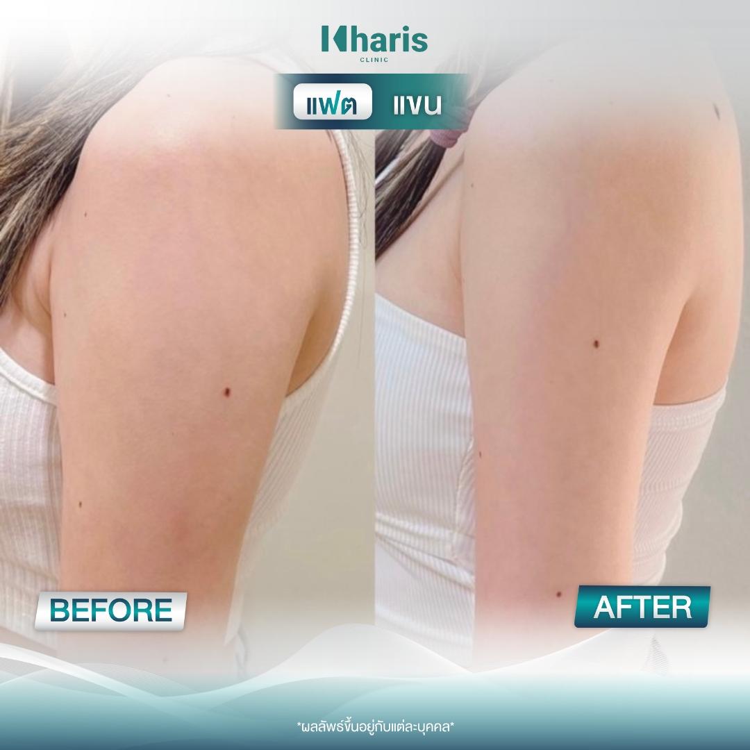 Fat Reduction review 7