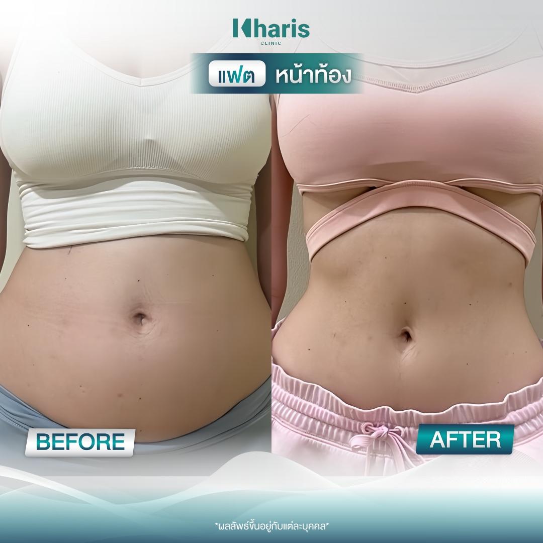 Fat Reduction review 8