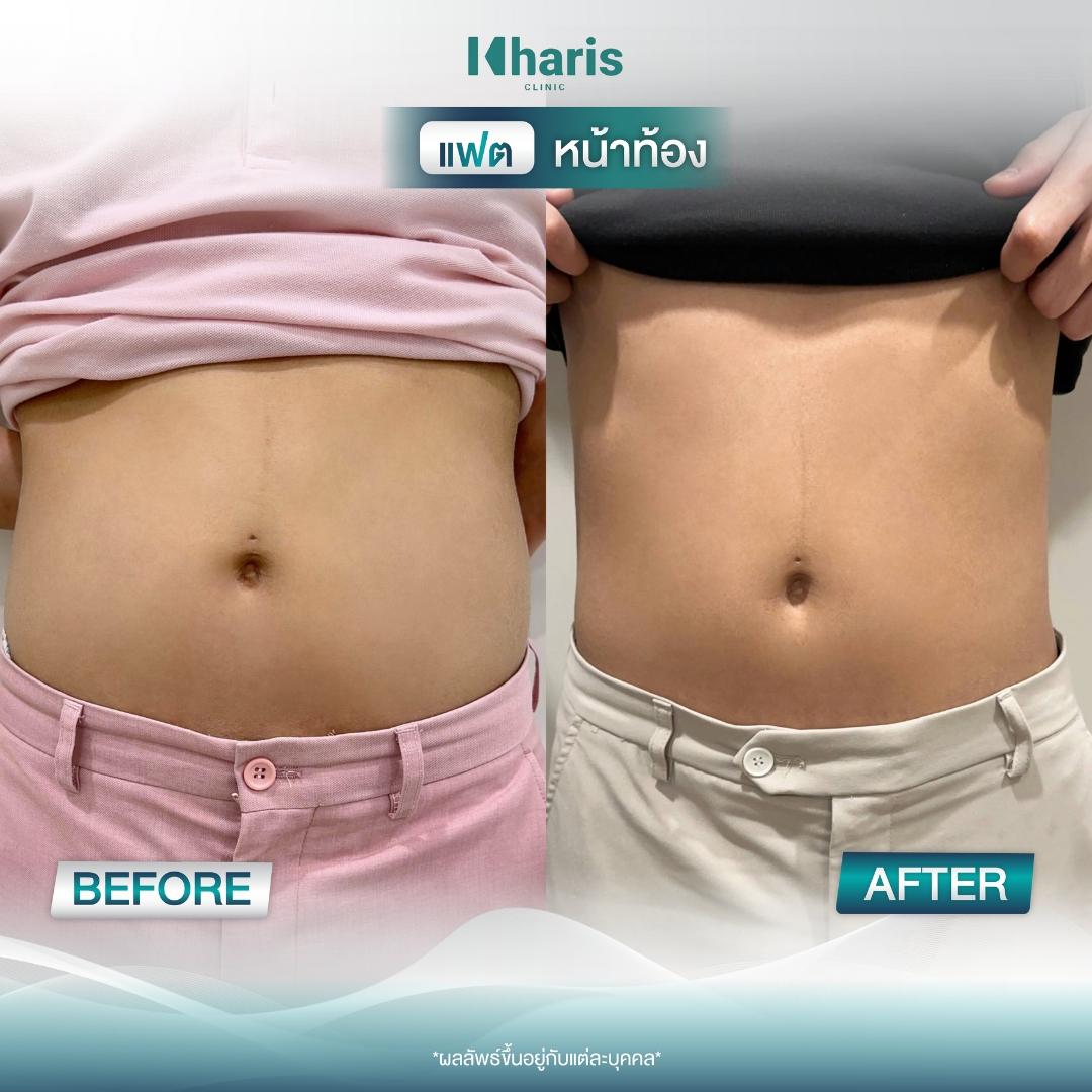 Fat Reduction review 9