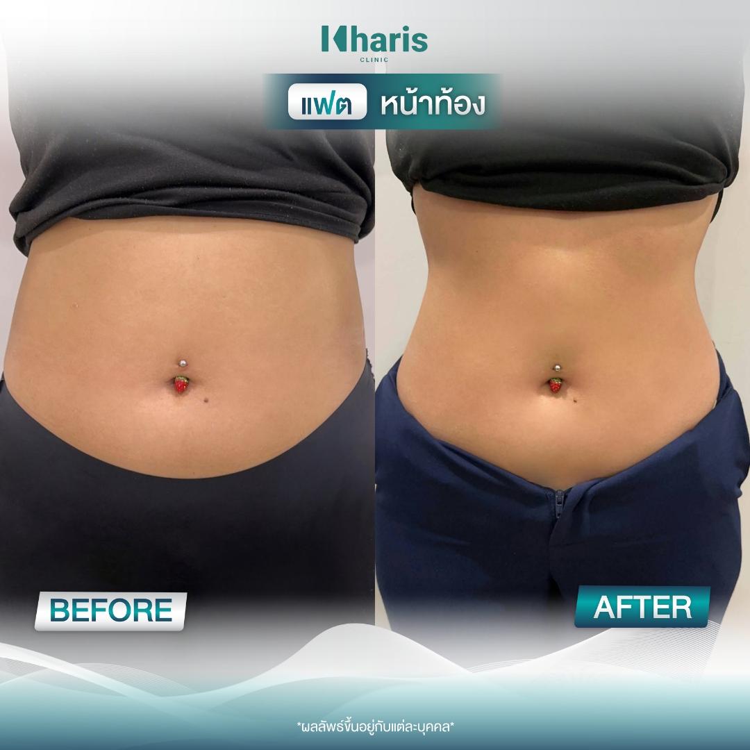 Fat Reduction review 10